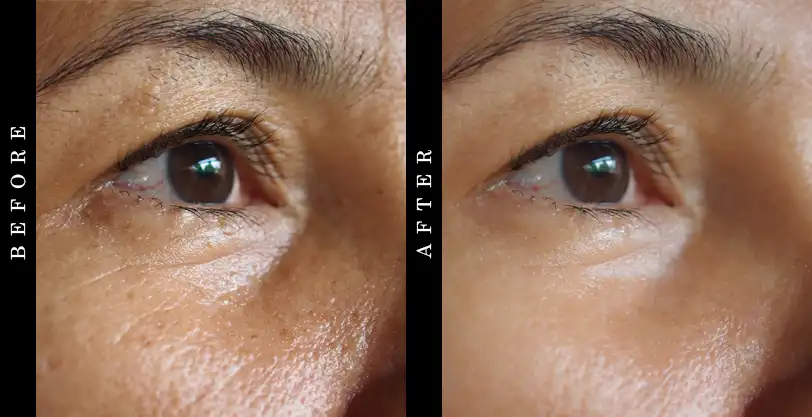Derma Progenix Before and After