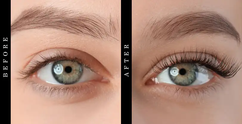 beverly-hills-md-lash before after