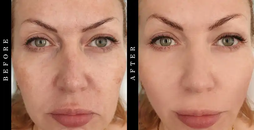 Dermal Repair Complex Before and After