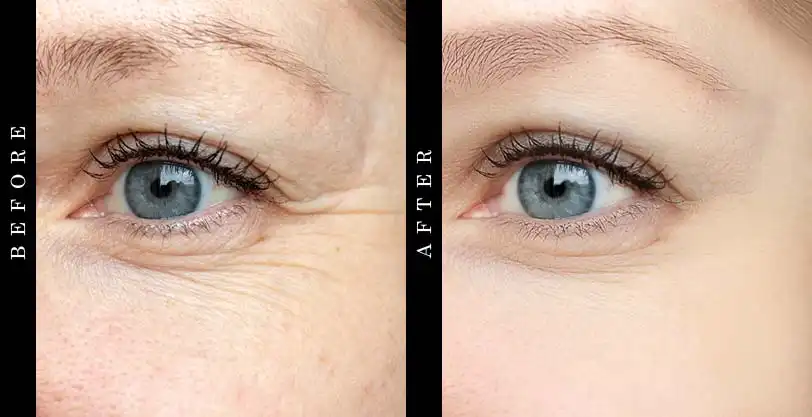 drmtlgy-needle-less-serum-before-after