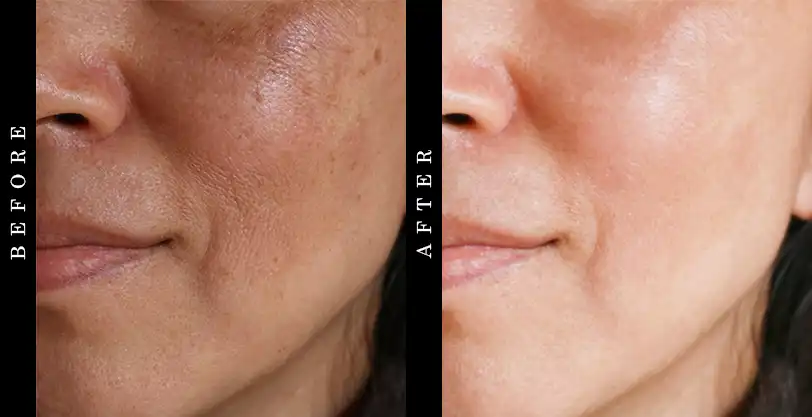 Drmtlgy Pumpkin Enzyme Mask Before and After