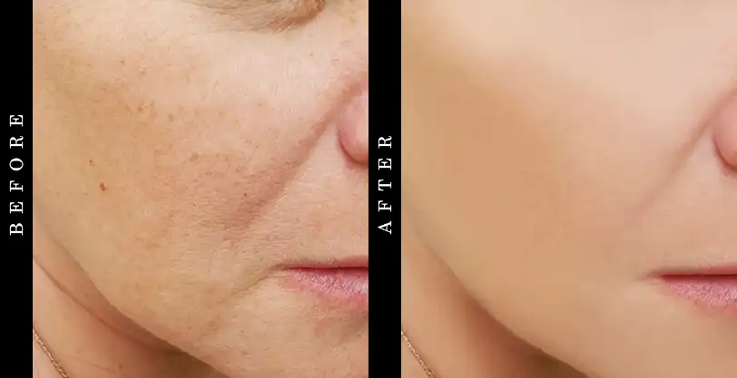 SkinCeuticals Equalizing Toner Before and After