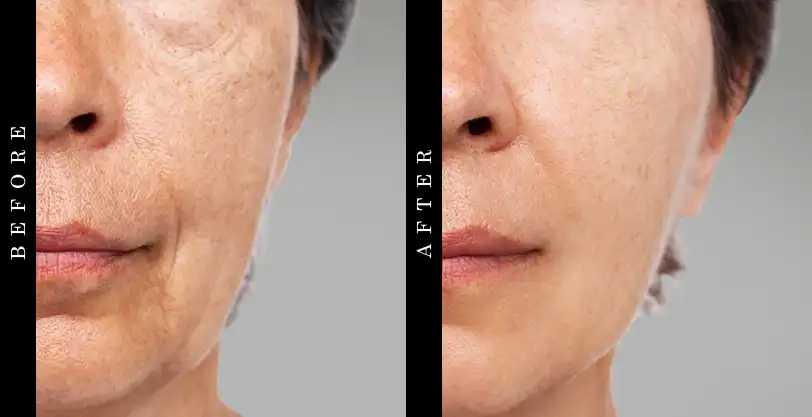 SkinCeuticals Biomedic Micro-Exfoliating Scrub