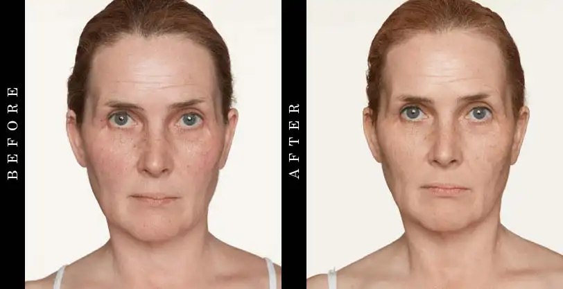 Tru Alchemy Eye Elixir Before and After