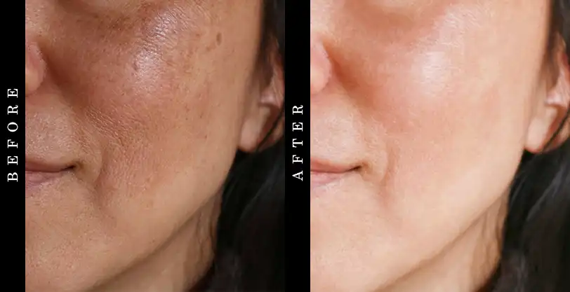 Tru Alchemy Glow Serum Before and After