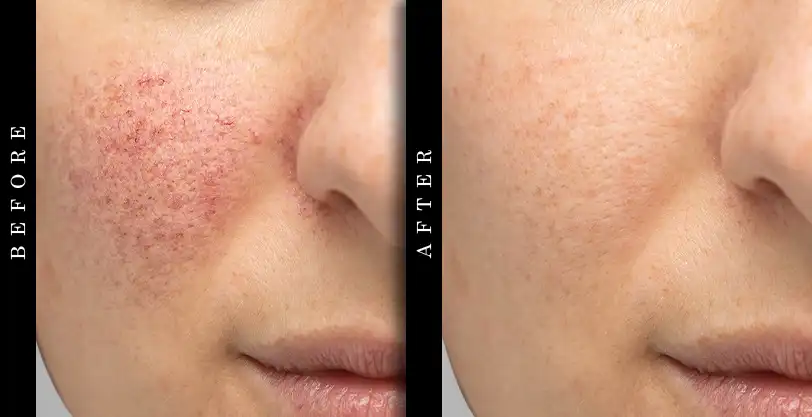 Truly Beauty Before and After