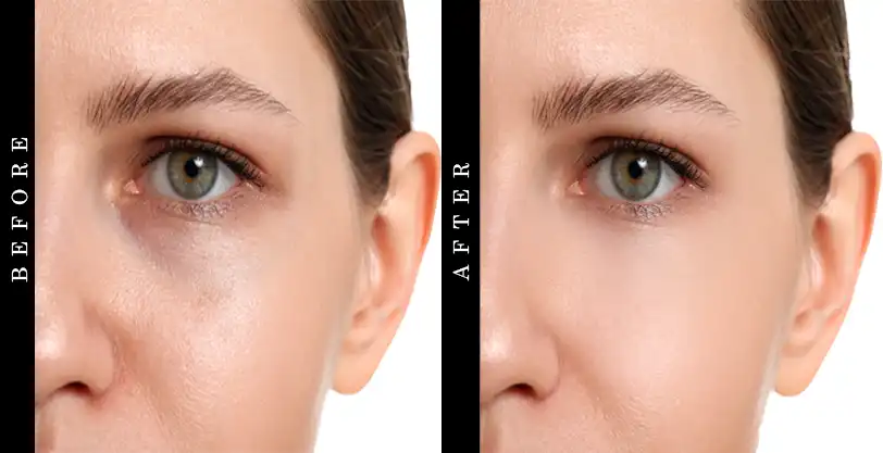 universal-tinted-moisturizer-spf-46 Before After